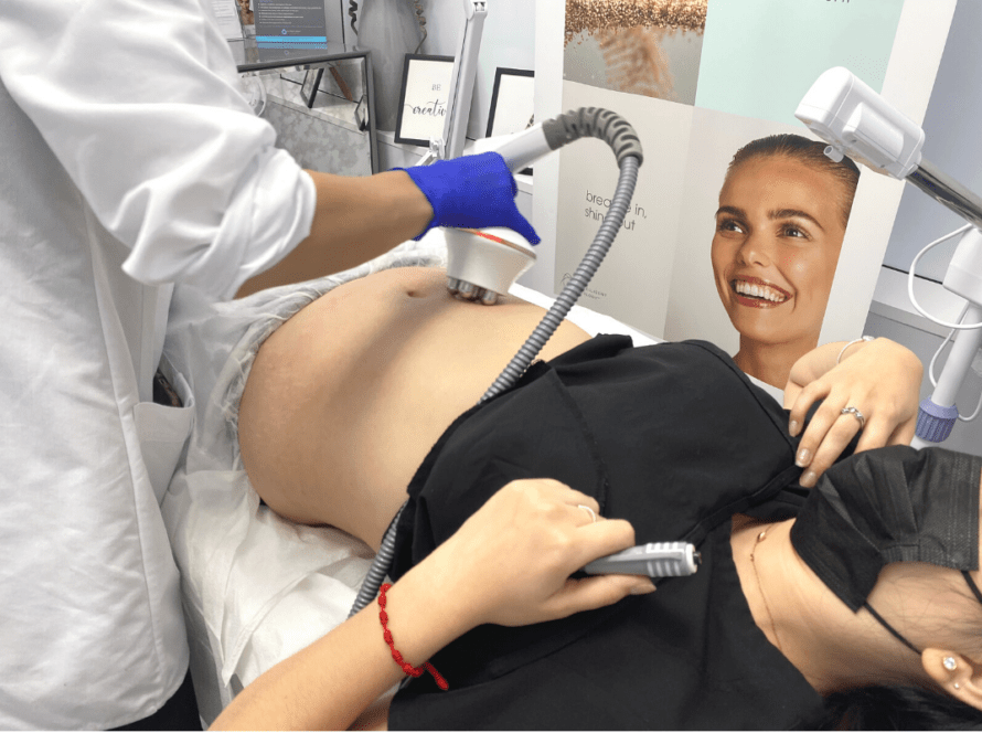 Radiofrequency body contouring
