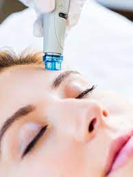 Hydrafacial vs midrodermabrasion endsntemed