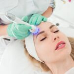 skin tightening treatment