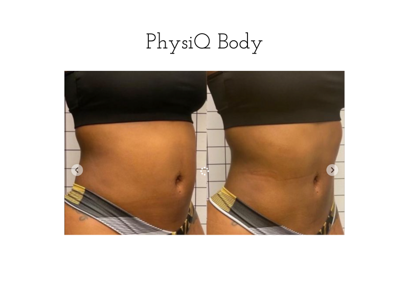 PhysiQ before and After