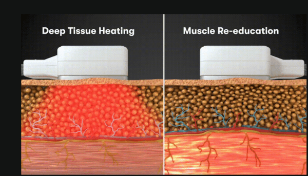 Physiq Muscle toning and fat reduction