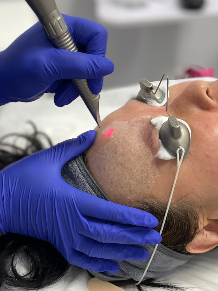 Medical grade laser skin treatments