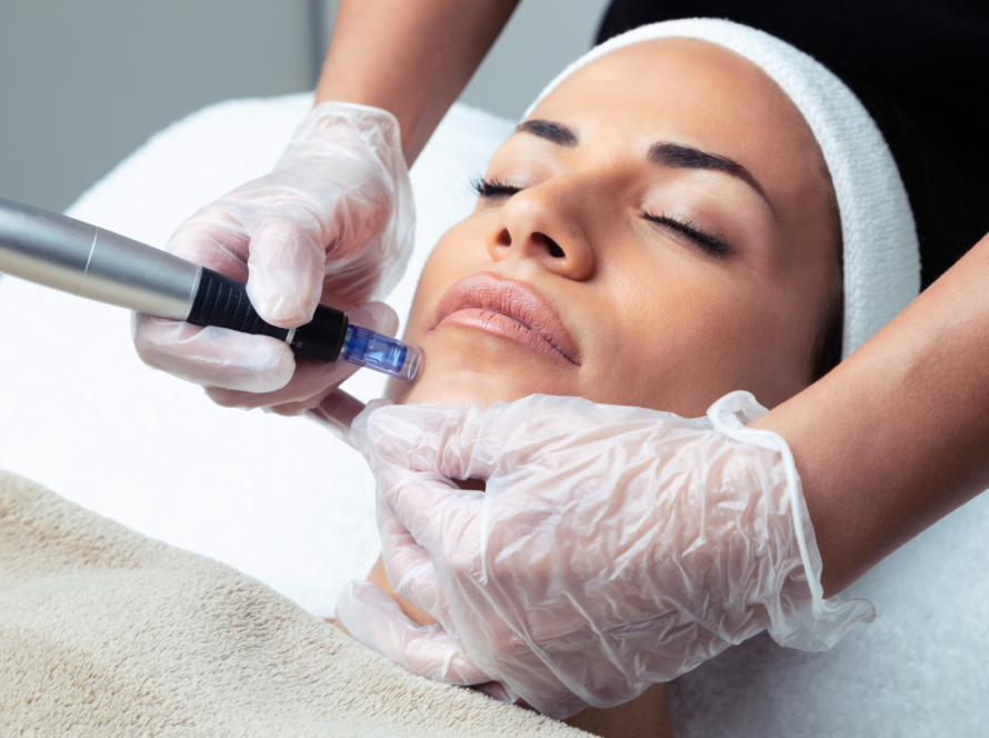 MICRONEEDLING