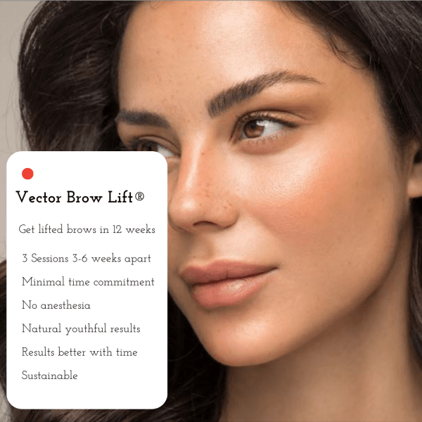 Fotona Vector Brow Lift