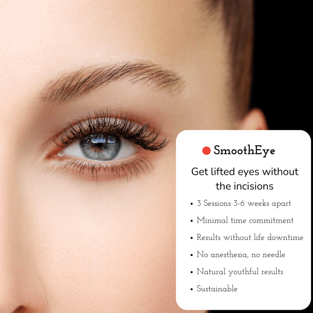 Fotona SmoothEye Laser Eye Lift