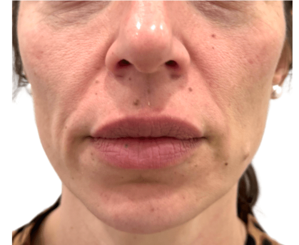 18 e1767394883846 aesthetic medical spa treatment McLean VA En Santé Med