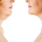 2986 aesthetic medical spa treatment McLean VA En Santé Med
