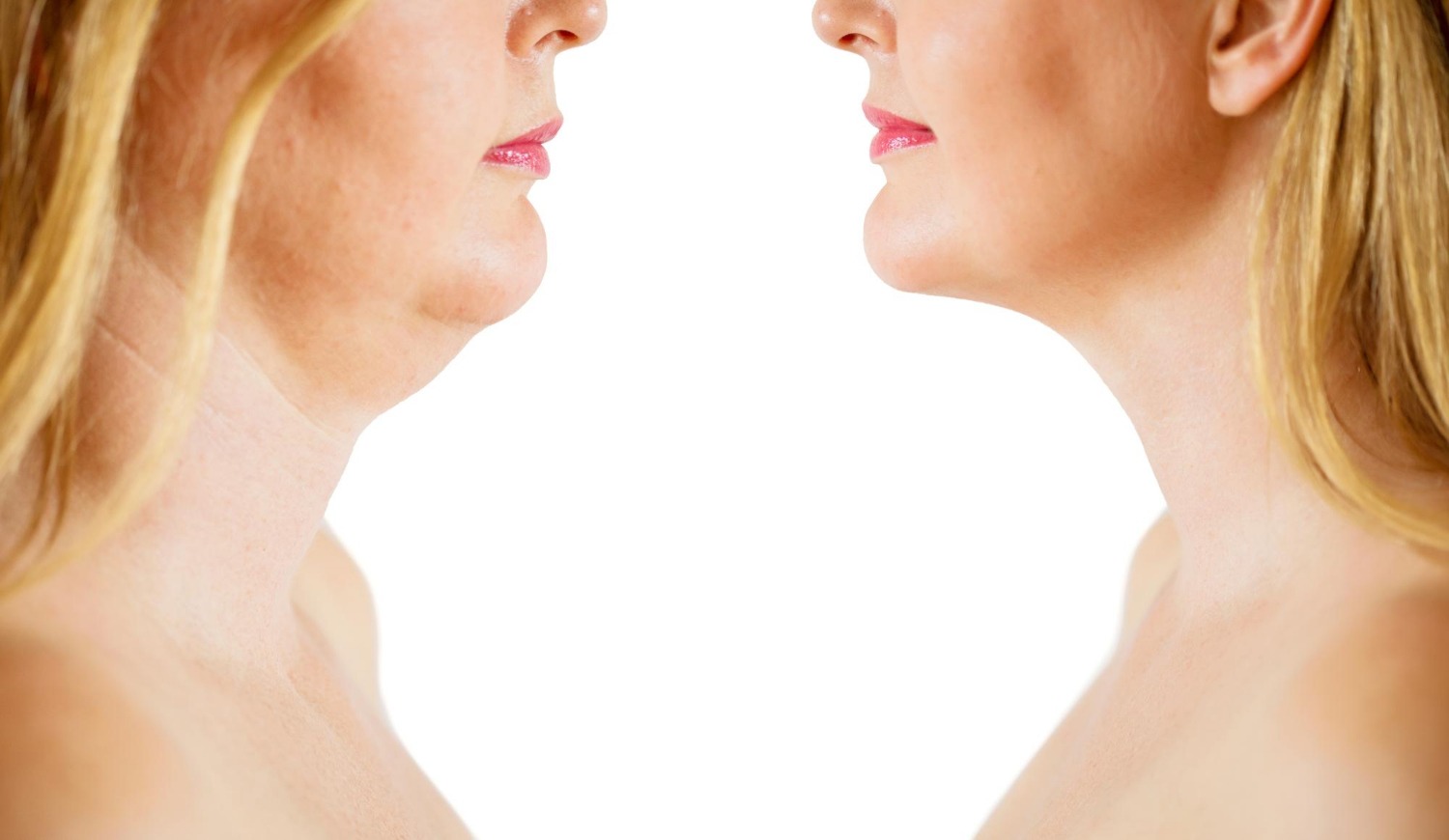 2986 aesthetic medical spa treatment McLean VA En Santé Med
