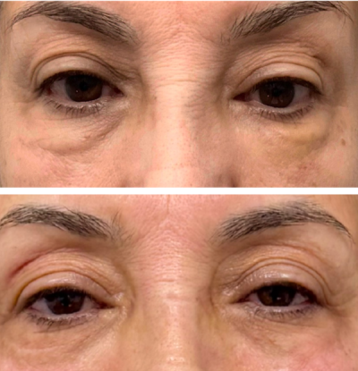 En Santé Clinic & Medical Spa in Tysons Corner, McLean VA provides advanced aesthetics Clinic, wellness, and longevity care with medical oversight. Med spa