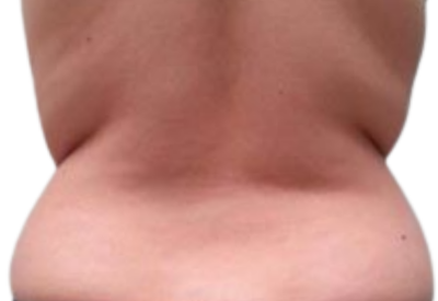 En Santé Clinic & Medical Spa in Tysons Corner, McLean VA provides advanced aesthetics Clinic, wellness, and longevity care with medical oversight. Med spa