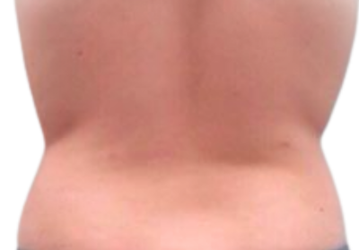 En Santé Clinic & Medical Spa in Tysons Corner, McLean VA provides advanced aesthetics Clinic, wellness, and longevity care with medical oversight. Med spa