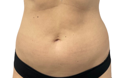 En Santé Clinic & Medical Spa in Tysons Corner, McLean VA provides advanced aesthetics Clinic, wellness, and longevity care with medical oversight. Med spa