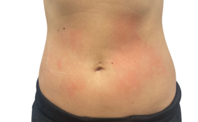 En Santé Clinic & Medical Spa in Tysons Corner, McLean VA provides advanced aesthetics Clinic, wellness, and longevity care with medical oversight. Med spa