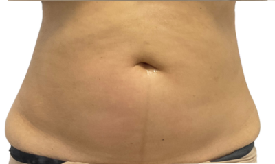 En Santé Clinic & Medical Spa in Tysons Corner, McLean VA provides advanced aesthetics Clinic, wellness, and longevity care with medical oversight. Med spa