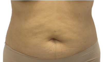 En Santé Clinic & Medical Spa in Tysons Corner, McLean VA provides advanced aesthetics Clinic, wellness, and longevity care with medical oversight. Med spa