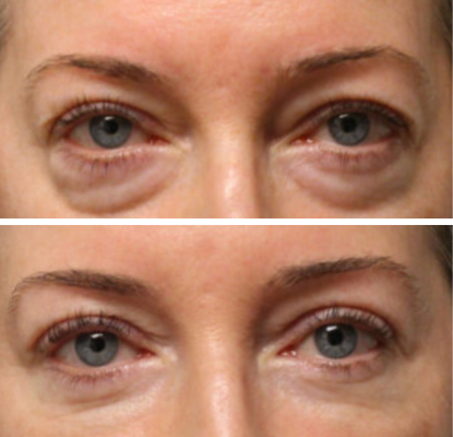 En Santé Clinic & Medical Spa in Tysons Corner, McLean VA provides advanced aesthetics Clinic, wellness, and longevity care with medical oversight. Med spa