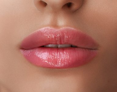Enhance lip volume, smooth fine lines, and improve lip texture naturally with LIPLASE™ laser lip augmentation—no needles, fillers, or downtime.