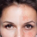 18059 e1773123084850 aesthetic medical spa treatment McLean VA En Santé Med