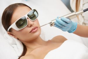 Fotona 4D laser at En Sante Clinc and Med Spa aesthetic medical spa treatment McLean VA En Santé Med