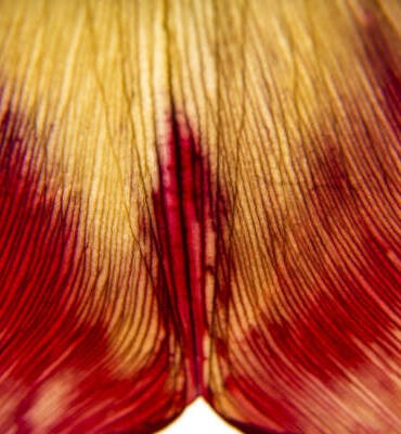 Labiaplasty En Sante Clinic and Medical Spa e1648351028778 370x400 1 aesthetic medical spa treatment McLean VA En Santé Med