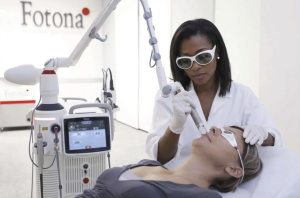 Laser Acne Scar Treatment in McLean, VA: Complete Guide to Lasers, Scar Types & Results 5