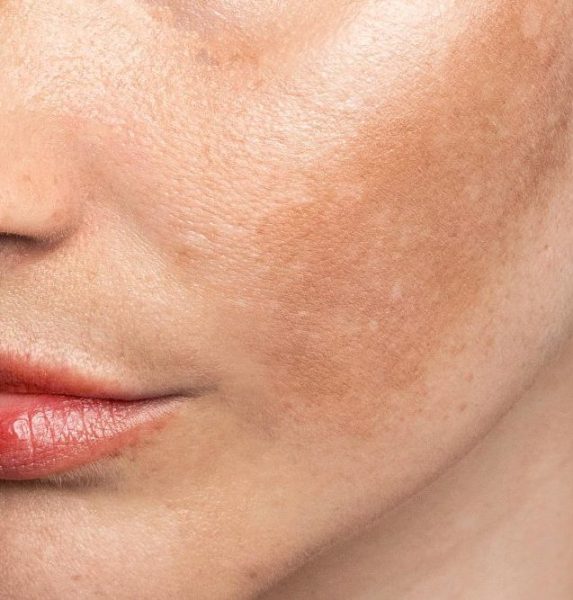 1309 e1773015016128 aesthetic medical spa treatment McLean VA En Santé Med