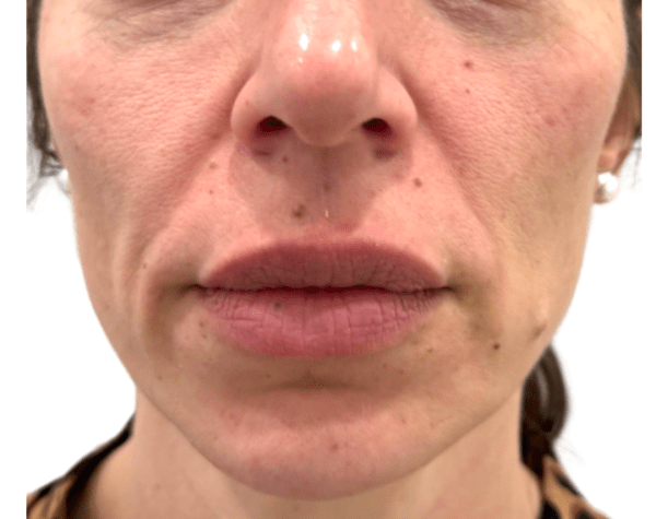 18 e1767394883846 aesthetic medical spa treatment McLean VA En Santé Med