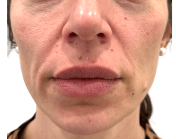 18 e1767394883846 aesthetic medical spa treatment McLean VA En Santé Med