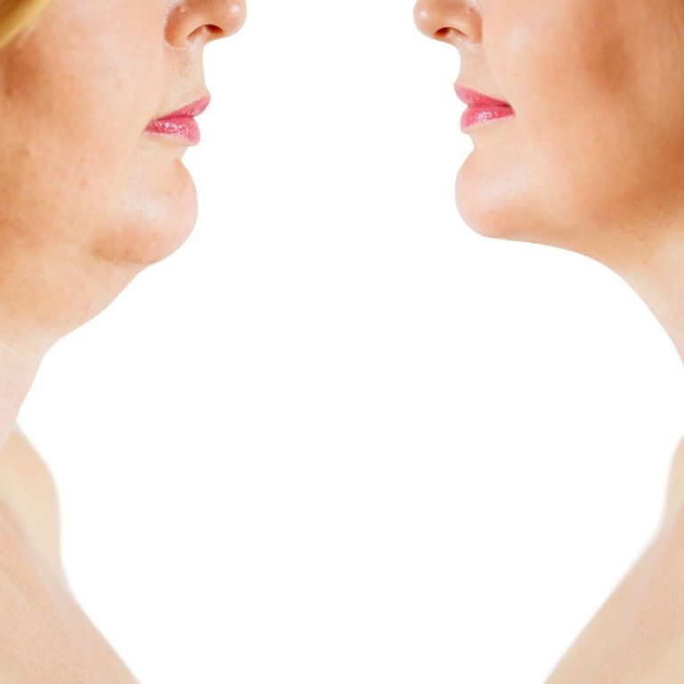 2986 aesthetic medical spa treatment McLean VA En Santé Med