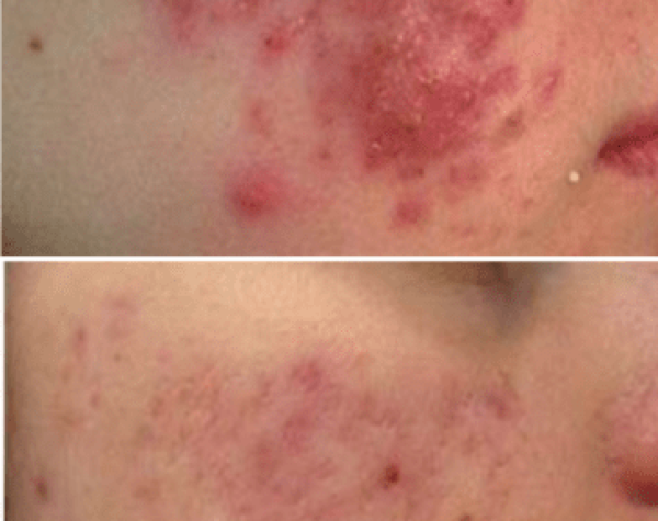 7 1 e1771786169921 aesthetic medical spa treatment McLean VA En Santé Med