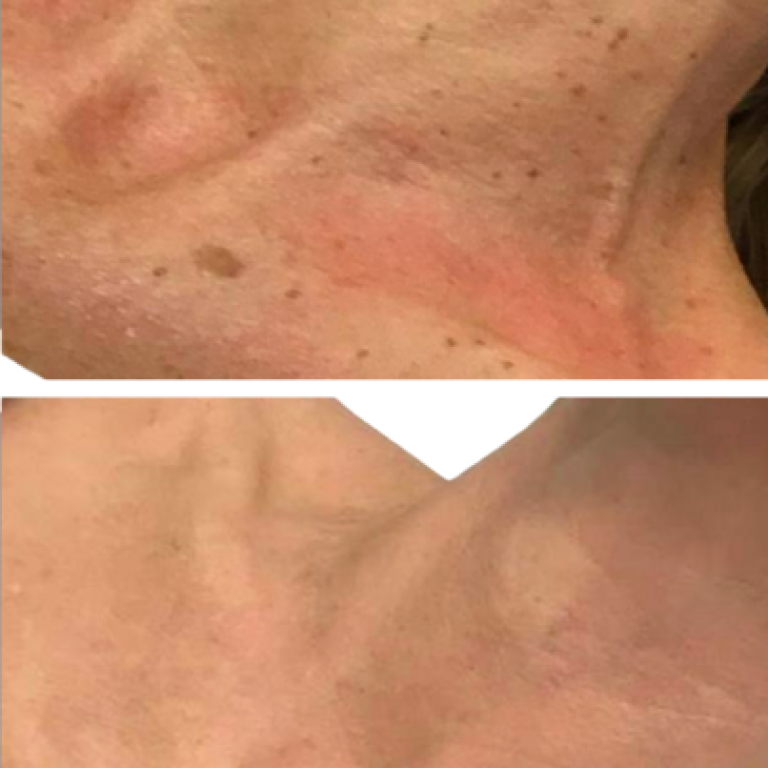 Gallery Before and after (1)