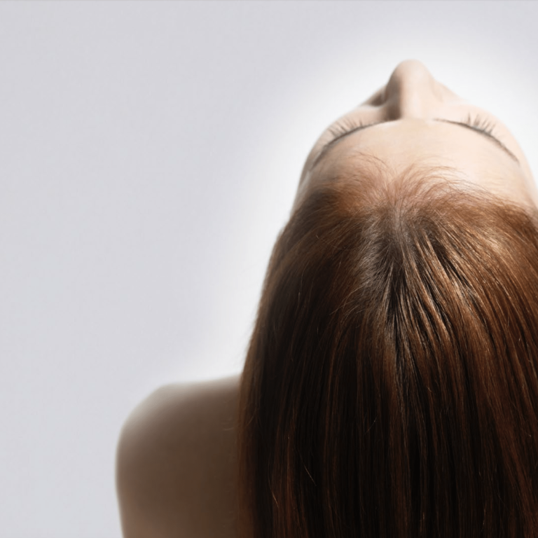 HAIR RESTORATION scaled aesthetic medical spa treatment McLean VA En Santé Med