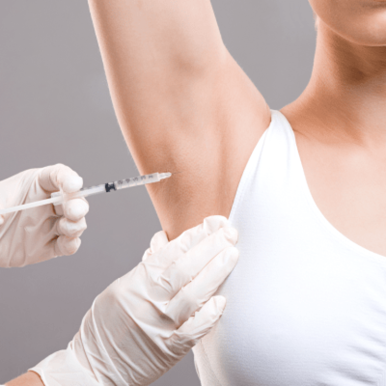 Hyperhidrosis 1 e1773163297297 aesthetic medical spa treatment McLean VA En Santé Med