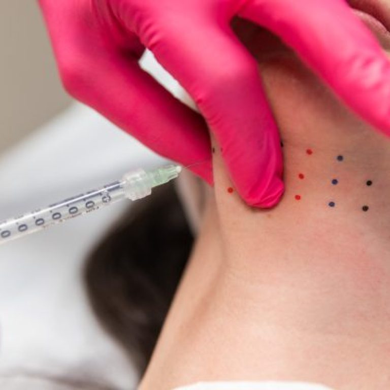 Kybella Lipodissolve injection
