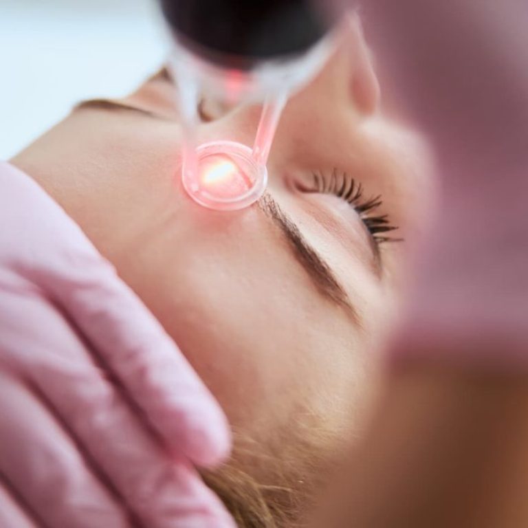 Laser-Resurfacing-Near-Me