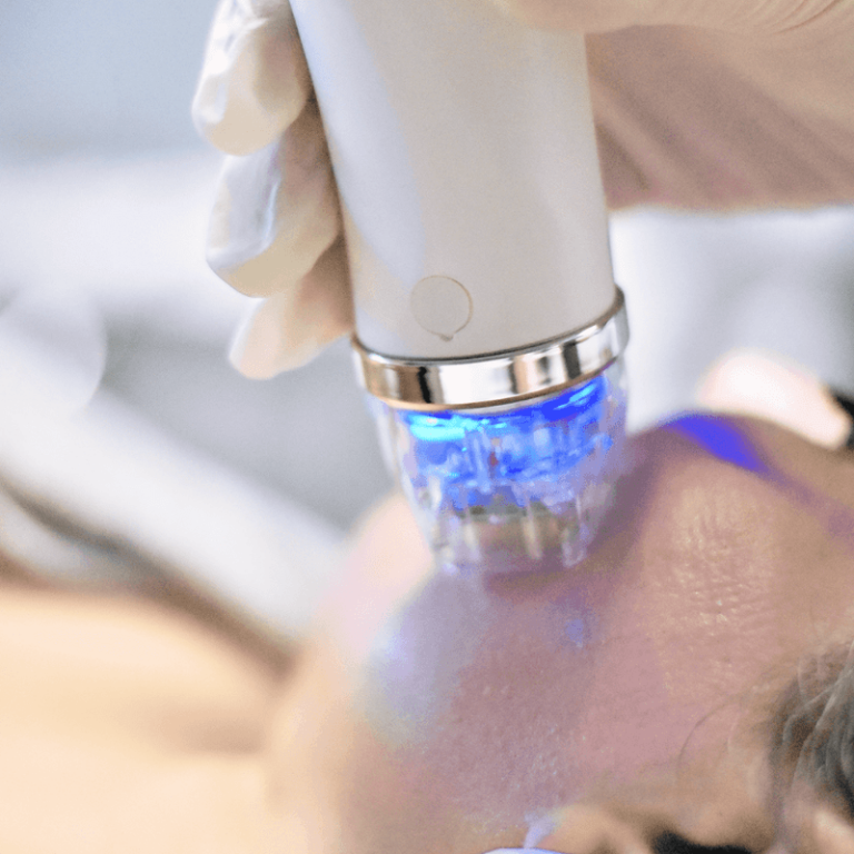 Microneedling-RF