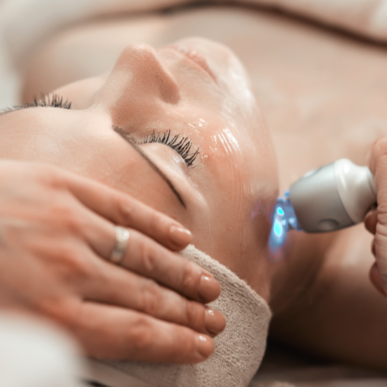 Radiofrequency Collagen Facial