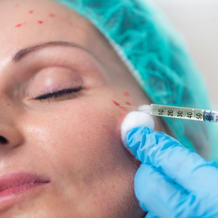 Anti-aging PRP Aesthetic Medicine Treatment