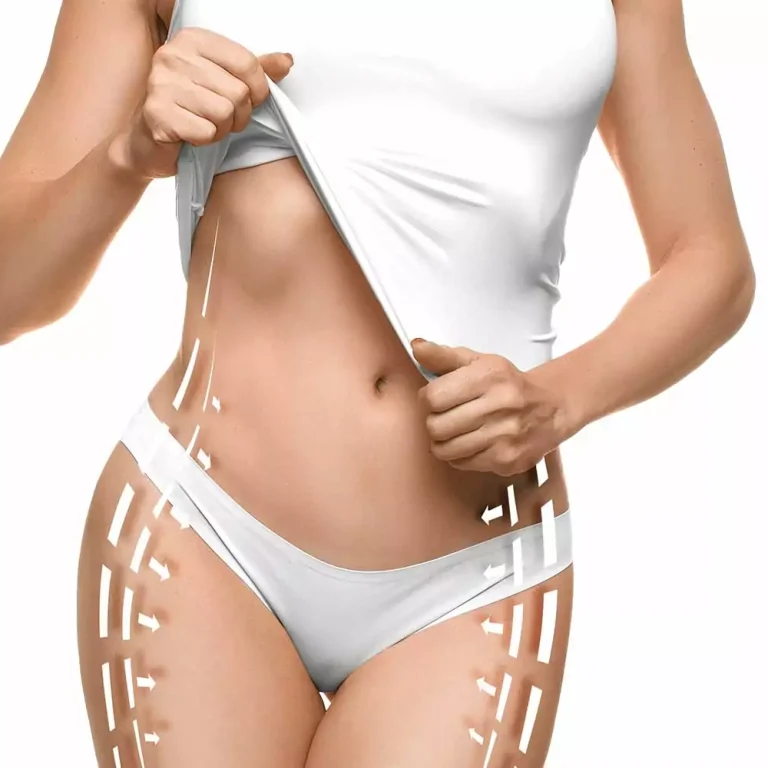 dr-lipp-aesthetische-medizin-hautstraffung-fettreduktion-fotona-tightsculpting-laser-1