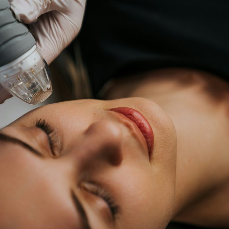 microneedle rf lifting procedure hardware cosmetology 1 1 aesthetic medical spa treatment McLean VA En Santé Med